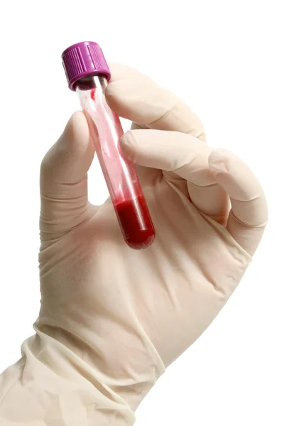Envase de sangre en mano con guante — Foto de Stock