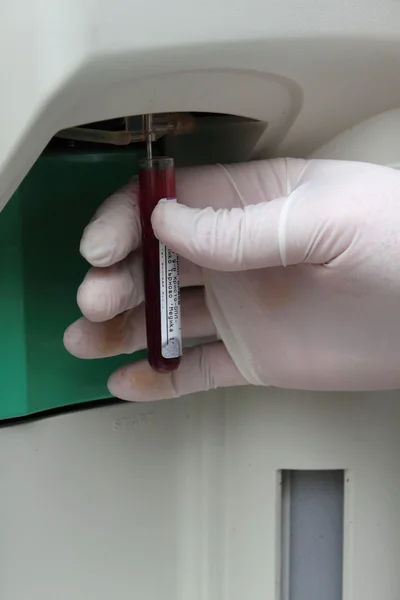 액션에서 혈액 샘플 분석기 — 스톡 사진
