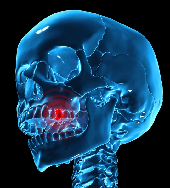 Медицинская иллюстрация зубной боли — стоковое фото
