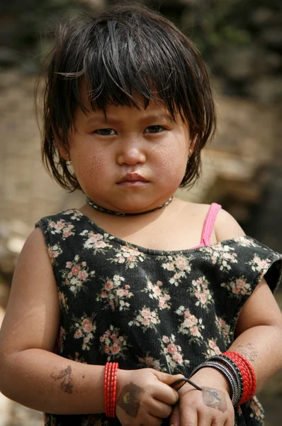 Ξηρό μάγουλο κορίτσι — Φωτογραφία Αρχείου