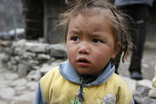 脏尼泊尔儿童 — 图库照片