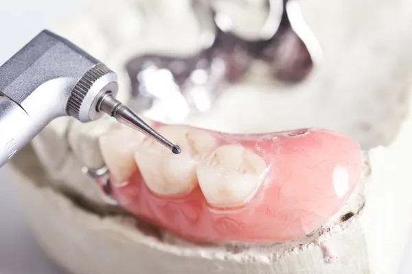 Assistenza sanitaria dentale — Foto Stock