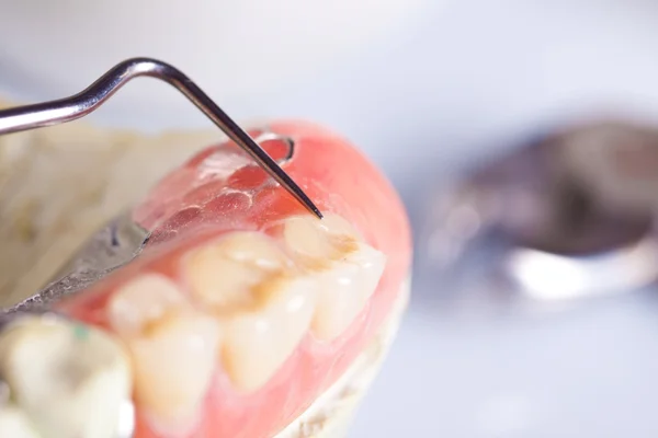 Οδοντιατρική περίθαλψη — Φωτογραφία Αρχείου