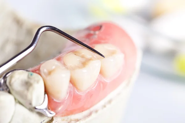 Zahncheck und sterile Bedingungen — Stockfoto