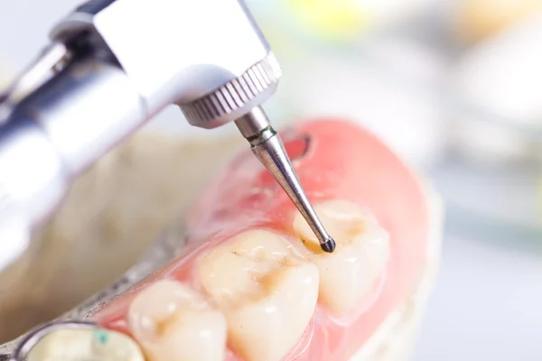 Zahncheck und Zahnpflege — Stockfoto