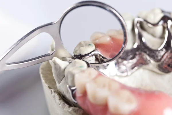 Verificação dentária e cuidados dentários — Fotografia de Stock