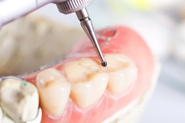 Проверка зубов и уход за зубами — стоковое фото