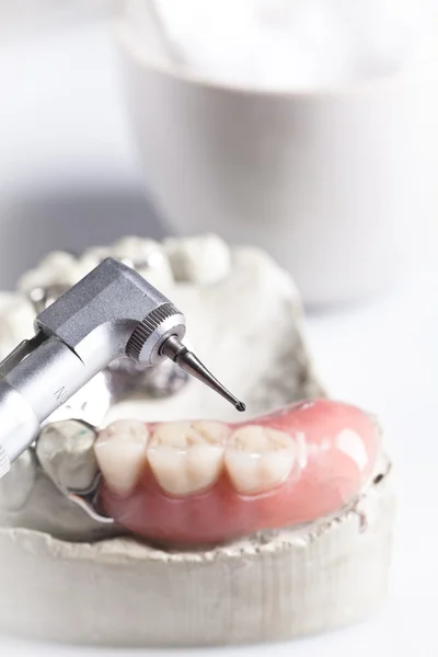 口腔と歯科チェック — ストック写真