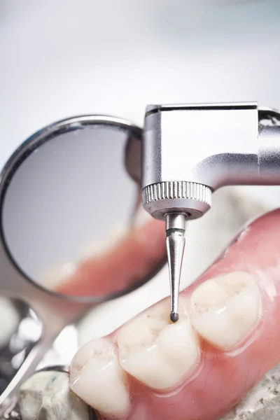Estomatología y control dental — Foto de Stock