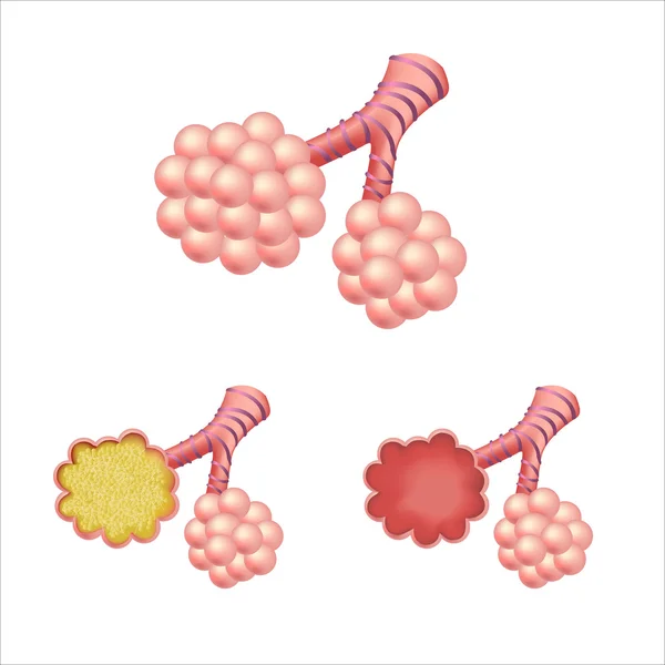 Alveoller küme — Stok Vektör