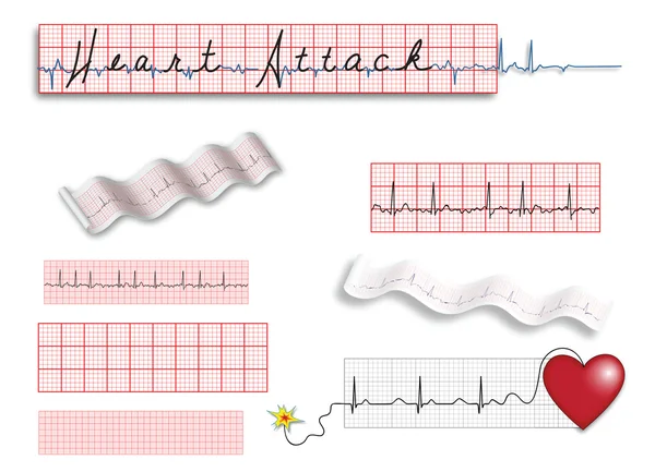 Página inteira de tiras de EKG com título e ilustrações no local —  Vetores de Stock
