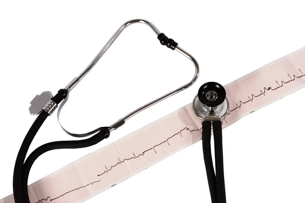 Fonendoscópio e cardiograma — Fotografia de Stock