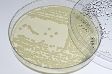 Bakteriyel t-çizgi agar plaka üzerinde