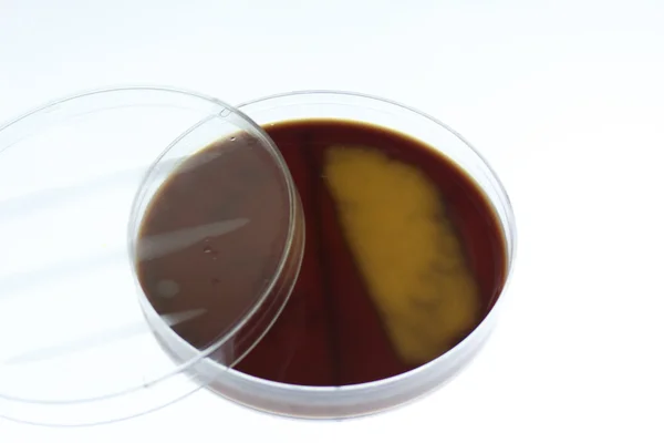 stock image Bacterial growth on chocolate agar