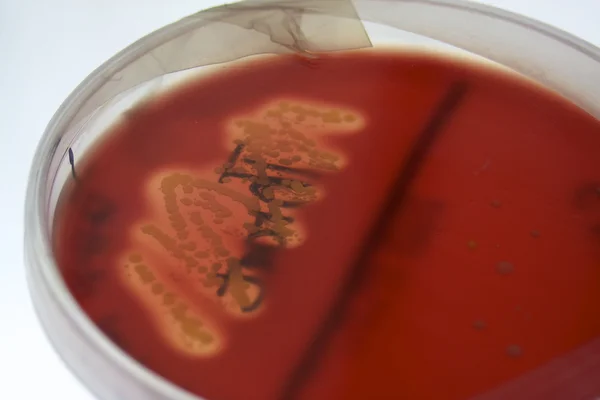 Hemolysis on blood agar plate — Stock Photo, Image