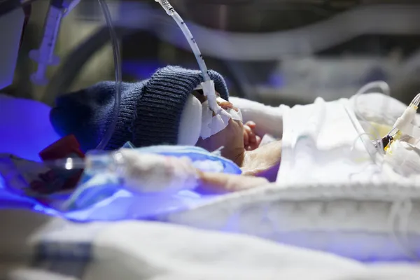Bebê prematuro — Fotografia de Stock