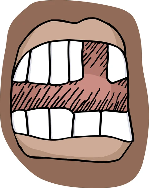 Eksik diş — Stok fotoğraf