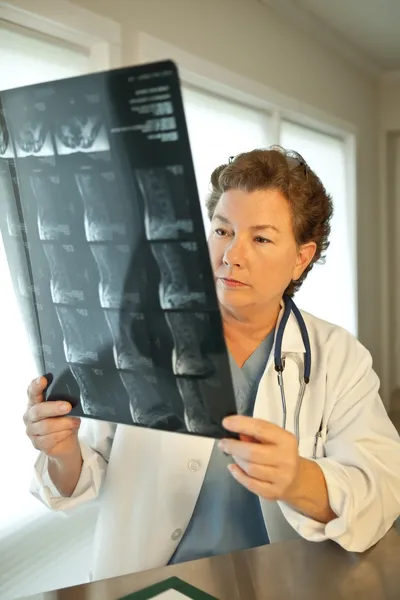 Kobieta lekarz czytanie skanów mri filmu — Zdjęcie stockowe