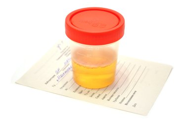 Analysis of urine clipart