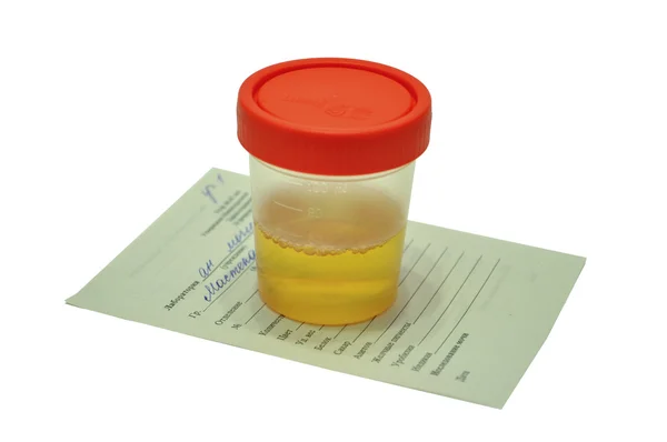 Analiza urinei — Fotografie, imagine de stoc