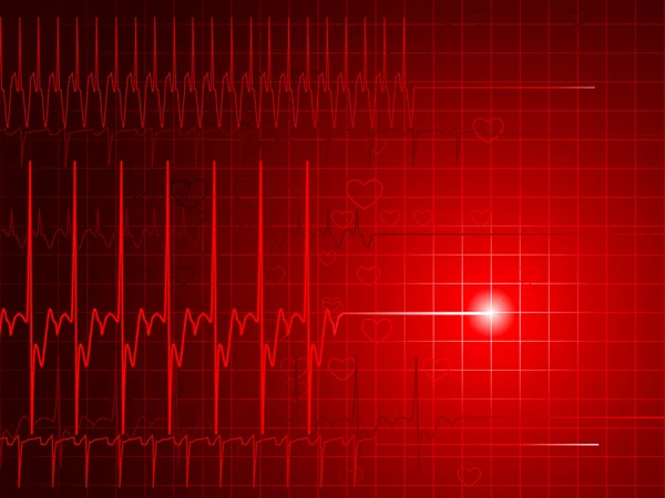 Sfondo rosso EKG — Vettoriale Stock