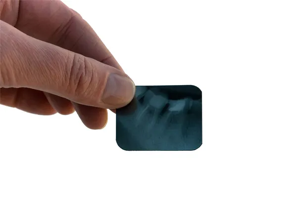 Рентген зубов — стоковое фото
