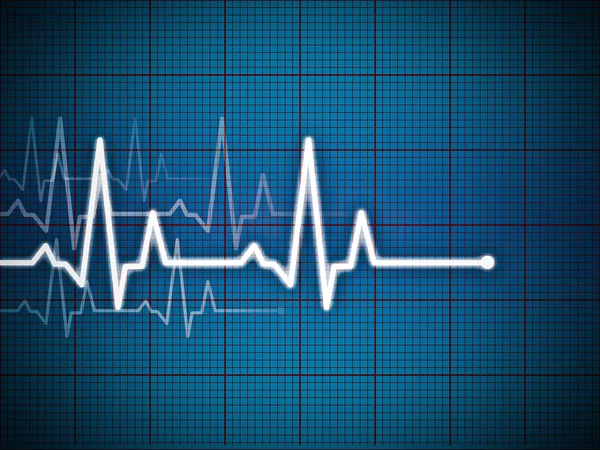 Cardiograma — Fotografia de Stock