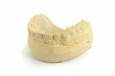 Teeth gypsum model clipart