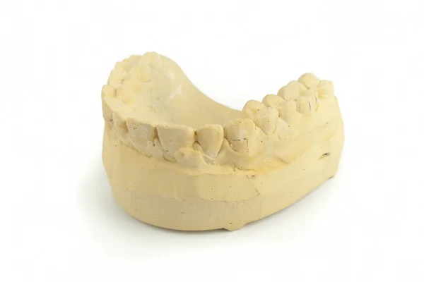 Modelo de gesso de dentes — Fotografia de Stock