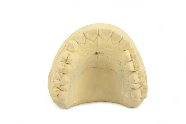 Modelo de gesso de dentes — Fotografia de Stock