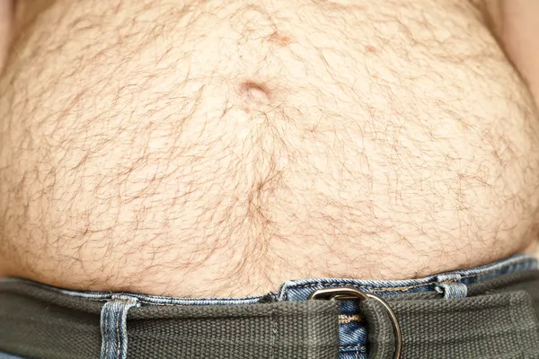 La grasa peludo estómago — Foto de Stock