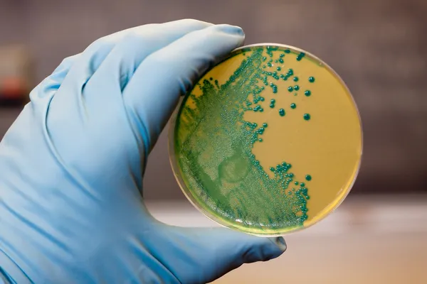 Bakterie Listeria — Zdjęcie stockowe