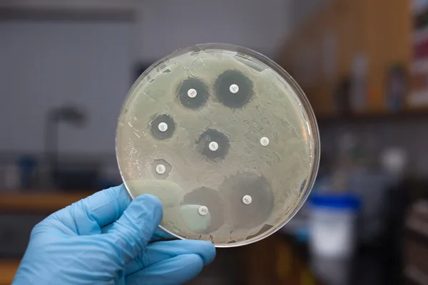 Тестирование на антибиотики — стоковое фото