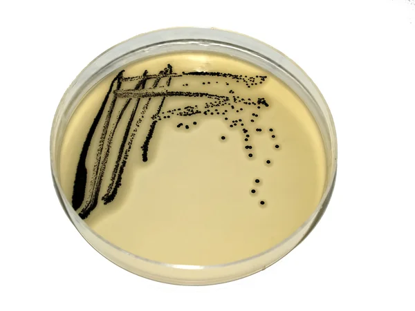 Bacteriële kolonies — Stockfoto