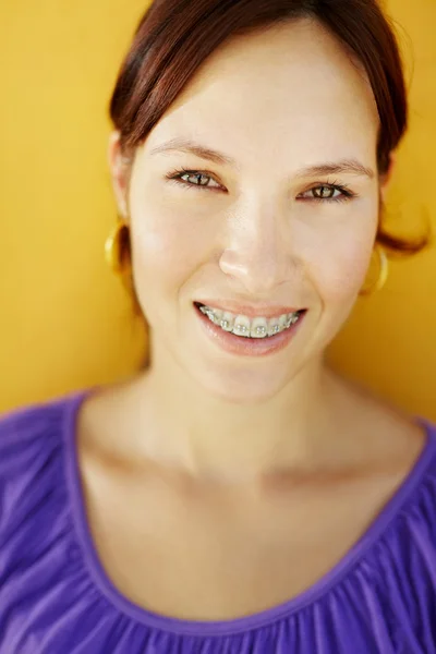 Młoda kobieta z aparaty ortodontyczne uśmiechający się — Zdjęcie stockowe