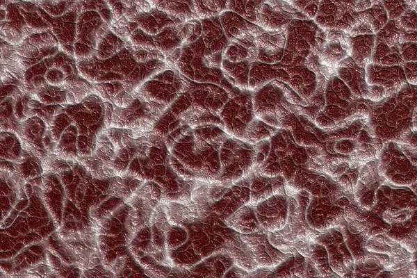 The texture of the heart muscle