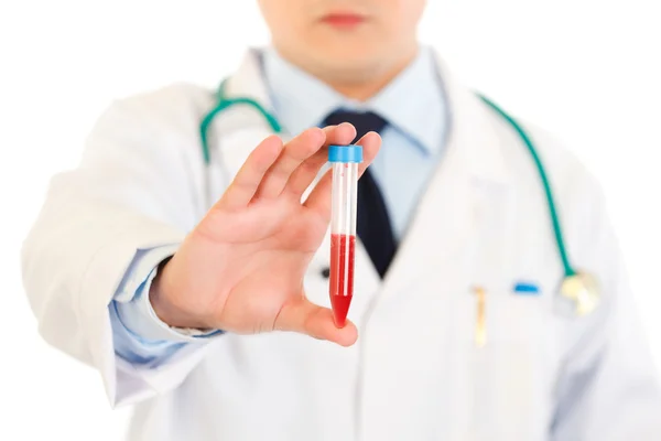 Medical doctor holding blood sample in hand. Close-up. — Stock Photo, Image