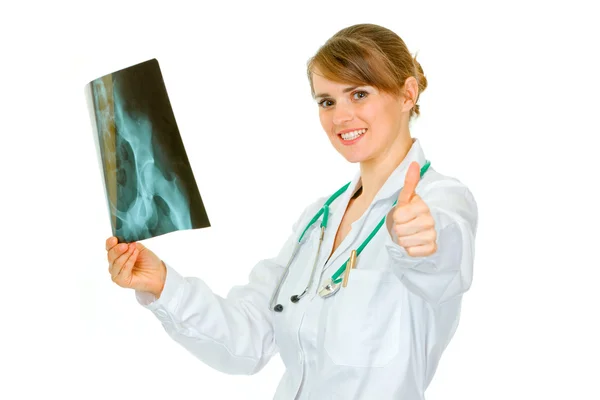 Pleased medical doctor woman holding pelvis roentgen and showing thumbs up — Stock Photo, Image