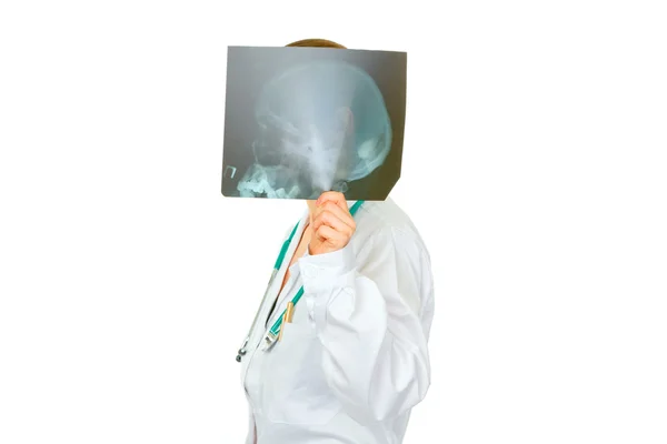 Médico médico femenino sosteniendo cráneos roentgen delante de su cabeza — Foto de Stock