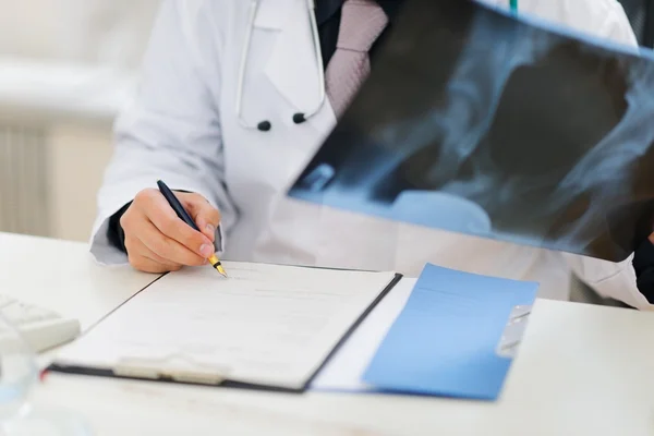 Detailní záběr na lékař držení pacientů rentgen a dělat n — Stock fotografie