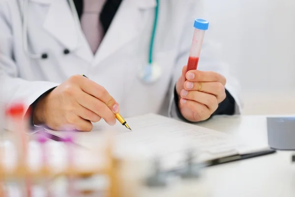 Closeup on hands of medical doctor holding blood sample and maki — Stock Photo, Image