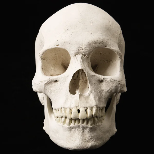 Ludzkiej czaszki. — Zdjęcie stockowe