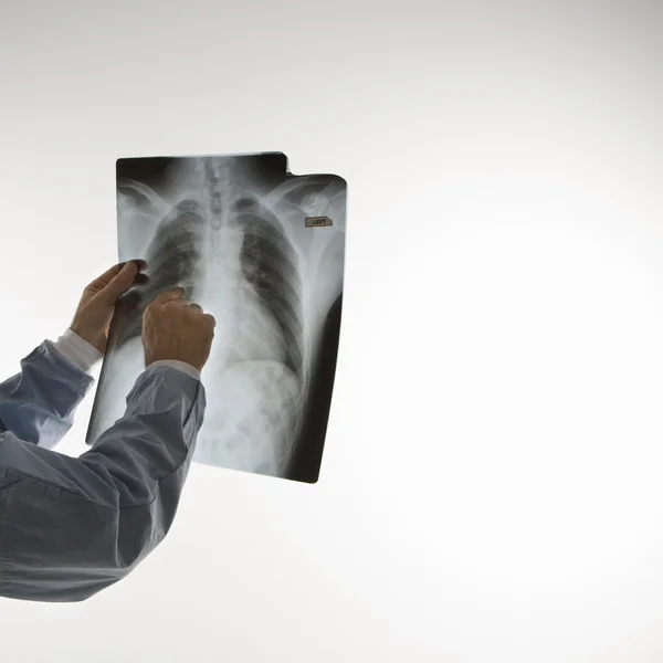 Доктор читає рентгенівські промені . — стокове фото