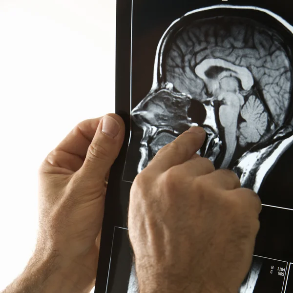 Man holding x ray. — Stock Photo, Image