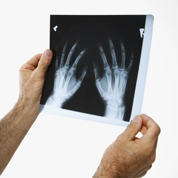 Homem segurando um raio-x . — Fotografia de Stock
