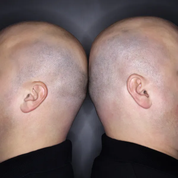 Δύο φαλακρών κεφαλών. — Φωτογραφία Αρχείου