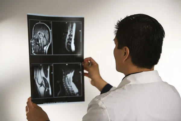 Doctor examining x-rays. — Stock Photo, Image