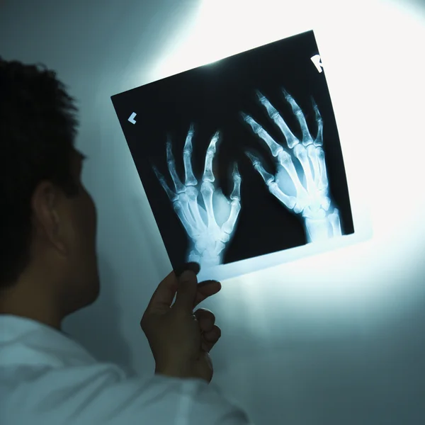 Γιατρός εξετάζει ακτινογραφίες. — Φωτογραφία Αρχείου