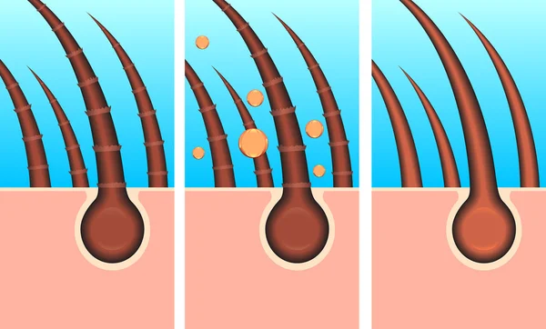 Illustrazione strato di capelli della pelle — Foto Stock