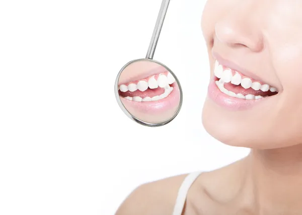 Здорові жіночі зуби і дзеркало рота стоматолога — стокове фото